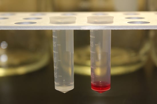 Optimized-tissue-collection-to-yield-quality-RNA-for-expression-profiling