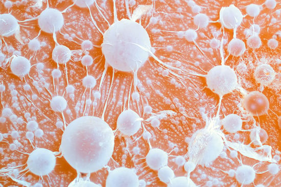 Cancer cells