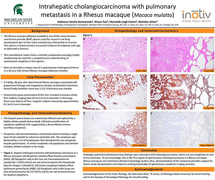 Sci-Poster-STP-2024-Intrahepatic-cholangiocarcinoma-with-pulmonary